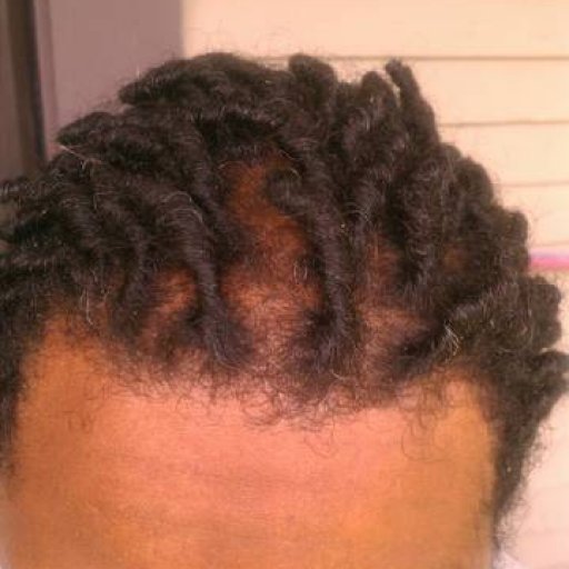 3mth front dread