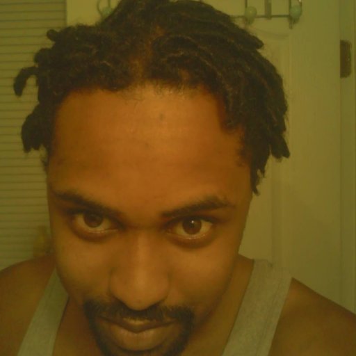 6 mth front smile dread