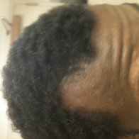 2 1/2 month hair regrowth
