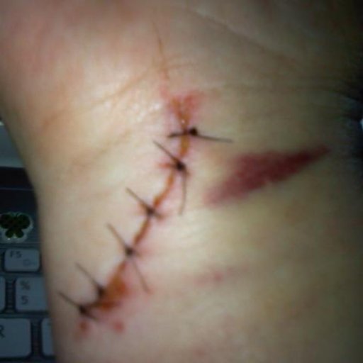 6 stitches from glass door