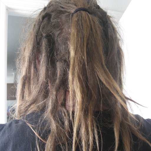 the back of my head